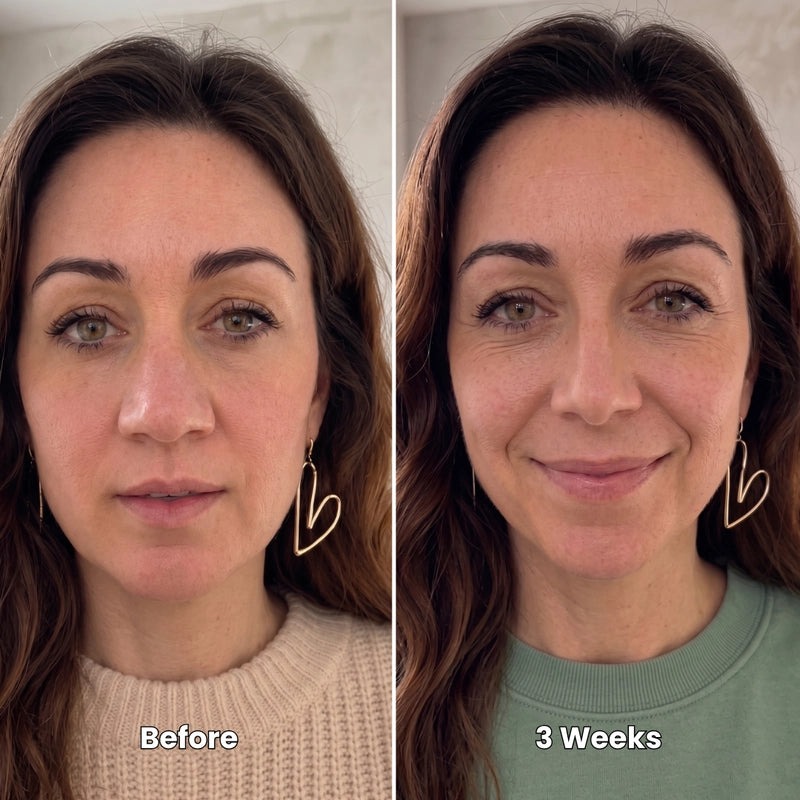 Hannah, Perth — before and after 3 weeks of daily Aboddex sessions